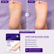 Exfoliating Foot Mask