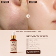Glow Rice Serum