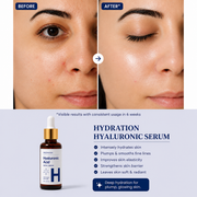 Hydration Hyaluronic Serum