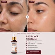 Radiance C Serum