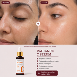 Radiance C Serum