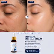 Renewal Retinol Serum