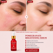 Pomegranate Brightening Serum