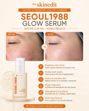 SEOUL 1988 Glow Serum: Niacinamide 15% + Yuja