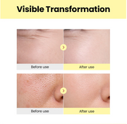 SEOUL 1988 Serum: Retinal Liposome 2% + Black Ginseng
