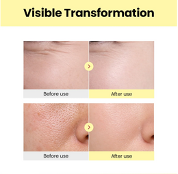 SEOUL 1988 Serum: Retinal Liposome 2% + Black Ginseng