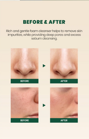 SEOUL 1988 Cleansing Foam : Pine Cica 1% + Probiotics