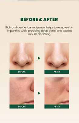 SEOUL 1988 Cleansing Foam : Pine Cica 1% + Probiotics